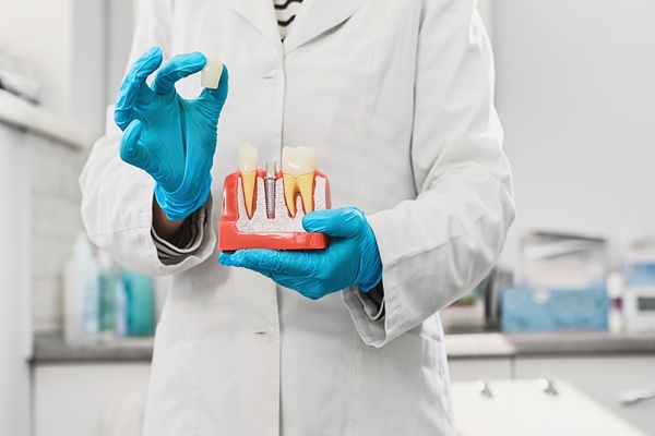 Dental Crown Types Compared: Porcelain Vs  Zirconia Vs  Metal (and How To Choose)