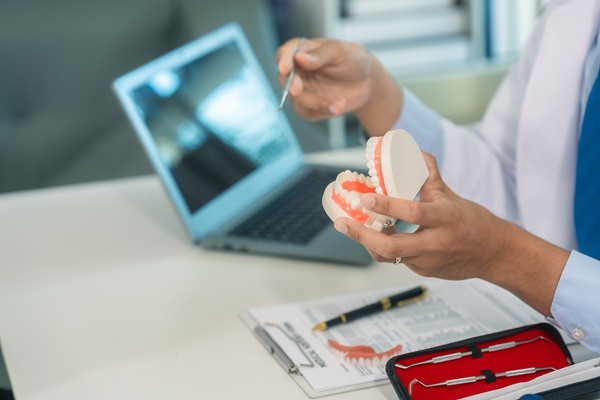 What To Know About The Dental Crown Process